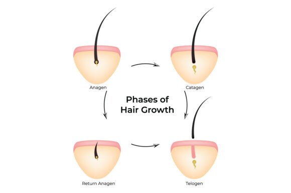 Phases of Hair Growth Infographic: Graphics & Illustrations